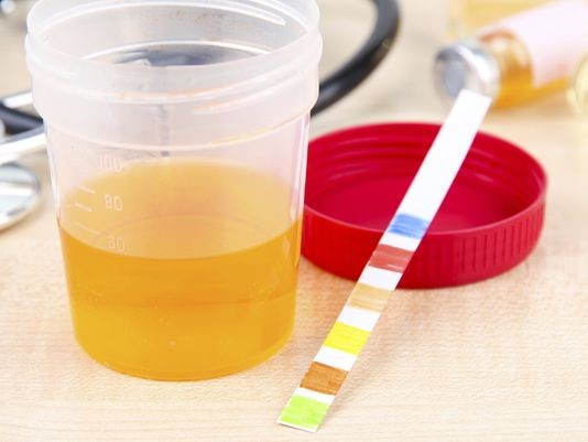 Synthetic Urine Shops Near 
      Me Windom Ranch Durango CO